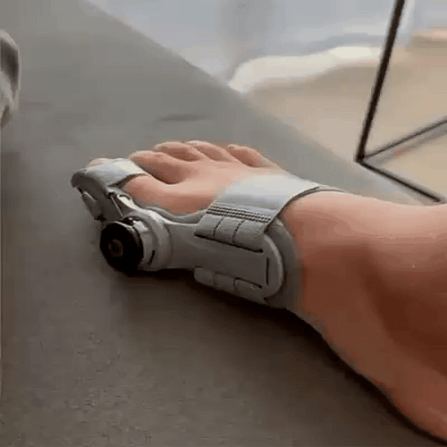 DevaArtı | Ortopedik Ayak Ateli